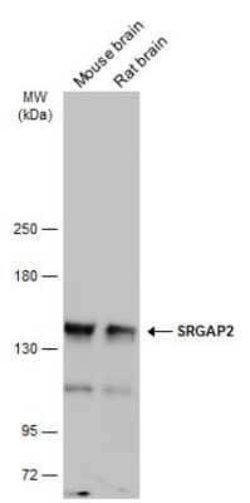 SRGAP2 Antibody, Novus Biologicals 100 &mu;g | Buy Online | Novus Biologicals | Fisher Scientific