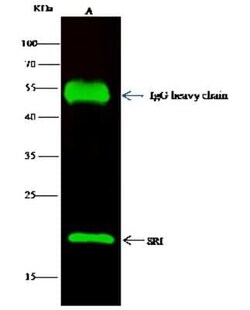 SRI Antibody, Novus Biologicals 50 &mu;g; Unconjugated:Anticuerpos