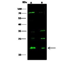 SRI Antibody, Novus Biologicals 50 &mu;g; Unconjugated:Anticuerpos