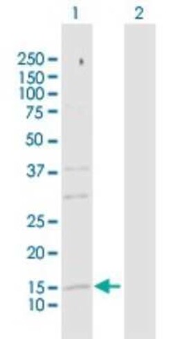 SRP19 Antibody, Novus Biologicals 0.1 mg | Buy Online | Novus Biologicals | Fisher Scientific