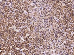 SRP72 Antibody, Novus Biologicals:Antibodies:Primary Antibodies