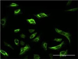 Novus Biologicals SRPK1 Antibody (2E8), Novus Biologicals 0.1 mg | Buy Online | Novus Biologicals&trade; | Fisher Scientific