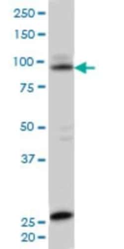 Novus Biologicals SRPK1 Antibody (2E8), Novus Biologicals 0.1 mg | Buy Online | Novus Biologicals&trade; | Fisher Scientific