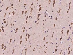 SRPK2 Antibody, Novus Biologicals:Antibodies:Primary Antibodies