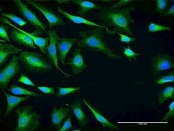 SRPR alpha Antibody, Novus Biologicals 0.05 mg | Buy Online | Novus Biologicals | Fisher Scientific
