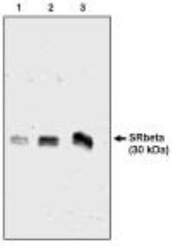 SRPRB Antibody, Novus Biologicals 250&mu;g:Antibodies, Polyclonal