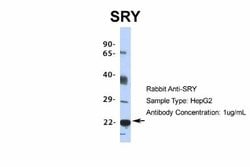 SRY Rabbit anti-Human, Polyclonal, Novus Biologicals 0.1 mL | Buy Online | Novus Biologicals | Fisher Scientific