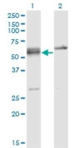 SRp55 Antibody (5G6), Novus Biologicals 0.1 mg | Buy Online | Novus Biologicals | Fisher Scientific