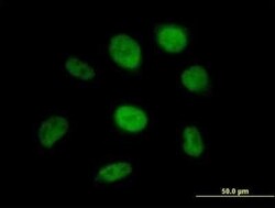 SS18 Antibody, Novus Biologicals 0.05 mg | Buy Online | Novus Biologicals | Fisher Scientific