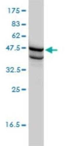SSB Antibody (1D6-H5), Novus Biologicals 0.1 mg | Buy Online | Novus Biologicals | Fisher Scientific