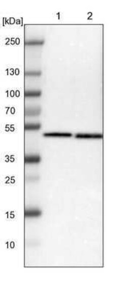 SSB Antibody, Novus Biologicals:Antibodies:Primary Antibodies