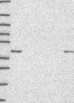 SSBP2 Rabbit anti-Human, Polyclonal, Novus Biologicals 25 &mu;g | Buy Online | Bio-Techne | Fisher Scientific