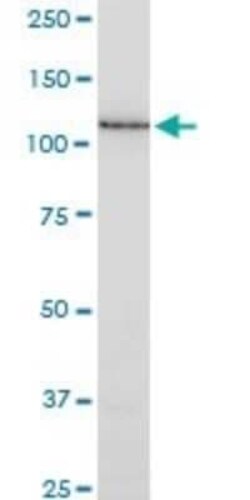 SSH1 Antibody (1D2), Novus Biologicals 0.1 mg | Buy Online | Novus Biologicals | Fisher Scientific