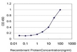 SSH3 Antibody (6F9), Novus Biologicals 0.1 mg; Unconjugated:Antibodies,