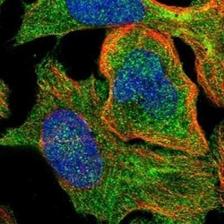 SSH3 Antibody, Novus Biologicals 0.1 mL | Buy Online | Novus Biologicals | Fisher Scientific