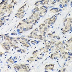 SSNA1 Antibody - BSA Free, Novus Biologicals:Antibodies:Primary Antibodies