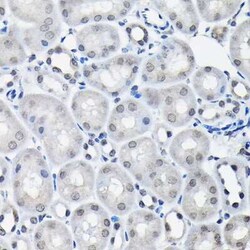 SSNA1 Antibody - BSA Free, Novus Biologicals:Antibodies:Primary Antibodies