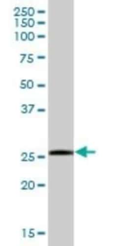 SSPN Antibody, Novus Biologicals 0.05 mg, Unconjugated:Antibodies, Polyclonal
