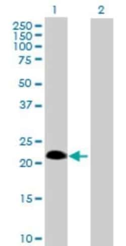 SSPN Antibody, Novus Biologicals 0.05 mg, Unconjugated:Antibodies, Polyclonal