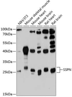 SSPN Antibody - Azide and BSA Free, Novus Biologicals 0.02 mL; Unconjugated:Antibodies,