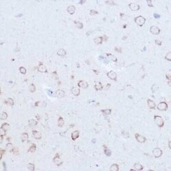 SSR2 Rabbit anti-Human, Mouse, Rat, Polyclonal, Novus Biologicals 20 &mu;g | Buy Online | Novus Biologicals | Fisher Scientific