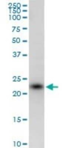 SSR2 Antibody, Novus Biologicals 0.05 mg | Buy Online | Novus Biologicals | Fisher Scientific