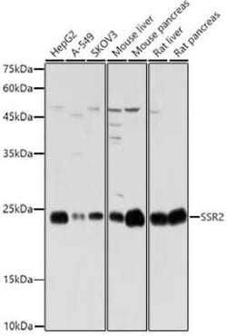 SSR2 Rabbit anti-Human, Mouse, Rat, Polyclonal, Novus Biologicals 20 &mu;g | Buy Online | Novus Biologicals | Fisher Scientific