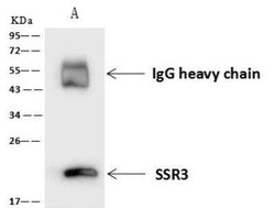 SSR3 Antibody, Novus Biologicals:Antibodies:Primary Antibodies
