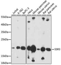 SSR3 Antibody - Azide and BSA Free, Novus Biologicals:Antibodies:Primary