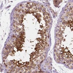 SSSCA1 Antibody, Novus Biologicals:Antibodies:Primary Antibodies