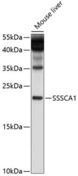 SSSCA1 Antibody - BSA Free, Novus Biologicals 0.02 mL, Unconjugated:Antibodies,