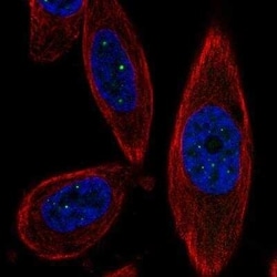 SSTK-IP Antibody, Novus Biologicals:Antibodies:Primary Antibodies