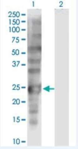 SSX1 Antibody (5B2), Novus Biologicals 100 &mu;g | Buy Online | Novus Biologicals | Fisher Scientific