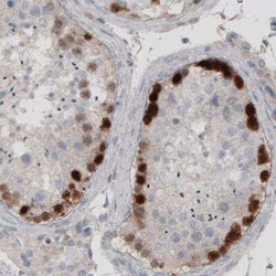 SSX2 Antibody (CL3202), Novus Biologicals:Antibodies:Primary Antibodies
