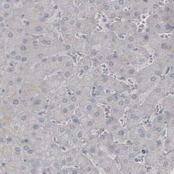 SSX2 Antibody (CL3202), Novus Biologicals:Antibodies:Primary Antibodies