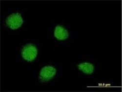 SSX4 Antibody (3E10), Novus Biologicals 0.1 mg, Unconjugated:Antibodies,