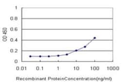 SSX4 Antibody (3E10), Novus Biologicals 0.1 mg, Unconjugated:Antibodies,