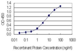 SSX4 Antibody (3E10), Novus Biologicals 0.1 mg, Unconjugated:Antibodies,
