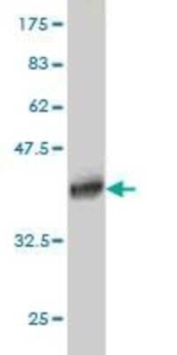 SSX4 Antibody (3E10), Novus Biologicals 0.1 mg, Unconjugated:Antibodies,