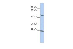 SSX4 Antibody, Novus Biologicals 100 &mu;L | Buy Online | Novus Biologicals | Fisher Scientific