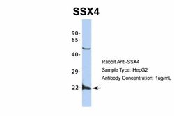 SSX4 Antibody, Novus Biologicals 100 &mu;L | Buy Online | Novus Biologicals | Fisher Scientific