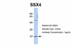 SSX4 Antibody, Novus Biologicals 100 &mu;L | Buy Online | Novus Biologicals | Fisher Scientific