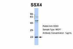 SSX4 Antibody, Novus Biologicals 100 &mu;L | Buy Online | Novus Biologicals | Fisher Scientific