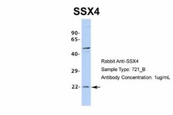 SSX4 Antibody, Novus Biologicals 100 &mu;L | Buy Online | Novus Biologicals | Fisher Scientific