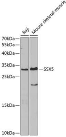 SSX5 Antibody - BSA Free, Novus Biologicals 0.1 mL; Unconjugated:Antibodies,