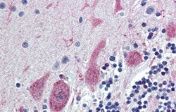 ST18 Rabbit anti-Human, Polyclonal, Novus Biologicals 0.1ml; Unconjugated:Antibodies,