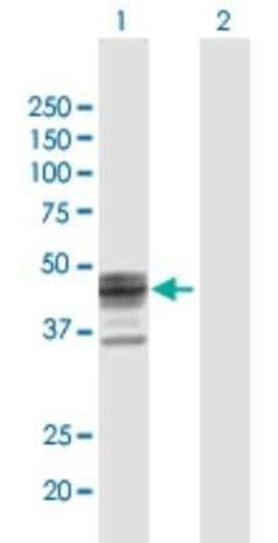 ST3 beta-Gal alpha-2,3-Sialyltransferase 1/ST3GAL1/SIAT4A Antibody, Novus Biologicals 0.05 mg | Buy Online | Novus Biologicals | Fisher Scientific