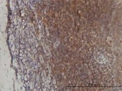 ST3 beta-Gal alpha-2,3-Sialyltransferase 2/ST3GAL2 Antibody (1E12), Novus Biologicals 0.1 mg | Buy Online | Novus Biologicals | Fisher Scientific