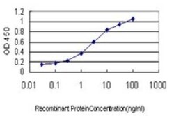 ST3 beta-Gal alpha-2,3-Sialyltransferase 2/ST3GAL2 Antibody (1E12), Novus Biologicals 0.1 mg | Buy Online | Novus Biologicals | Fisher Scientific