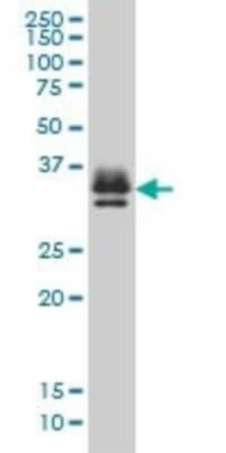 ST3 beta-Gal alpha-2,3-Sialyltransferase 2/ST3GAL2 Antibody (1E12), Novus Biologicals 0.1 mg | Buy Online | Novus Biologicals | Fisher Scientific